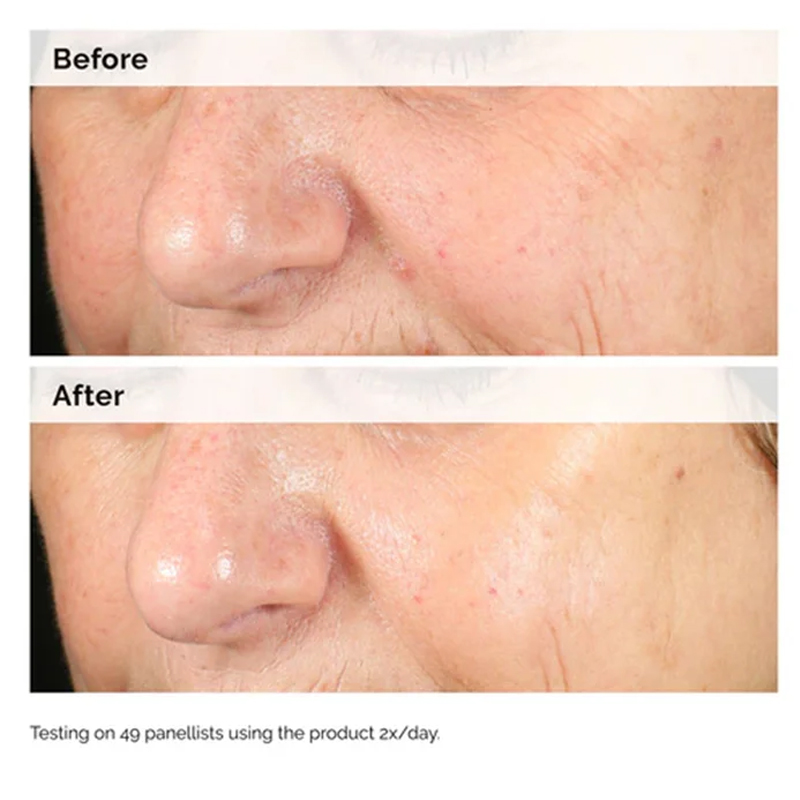 Alfa Arbutin %2 + HA 30ml Seru - Azelaic Acid Serum incelemesi ve fiyatı