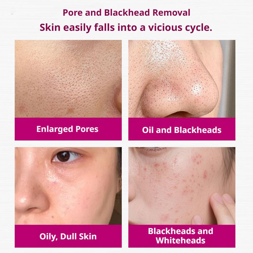 Salisilik Asit Gözenekleri Sık - Skincare Skintific incelemesi ve fiyatı